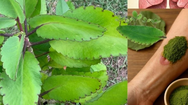 Astuces santé bienfaits Kalanchoe Plante médicinale Remède naturel Soins par les plantes 
