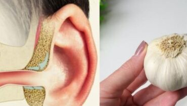 Accident du travail Bien-être Auriculaire Douleurs d'Oreille Remèdes naturels Santé Auriculaire