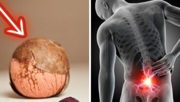 Avocats Bienfaits santé Douleurs articulaires Douleurs dorsales Polyphénols Remèdes naturels