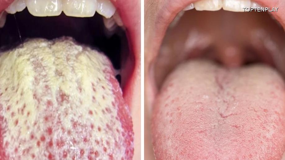 Symbolbild © TopTenPlay