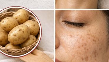 Aloe vera Cosmétique Maison Éclat peau Nettoyant visage Pomme de terre Recette naturelle Soin peau 