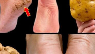 Beauté naturelle Déshydratation Peau morte Remèdes naturels Soins des pieds Talons fendillés