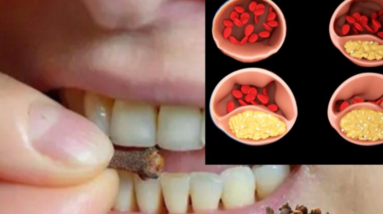 Bienfaits santé Clous de girofle Digestion Épices Immunité Santé naturelle