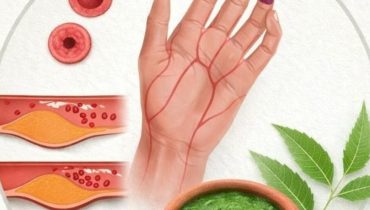 bien être Circulation sanguine glycémie inflammation Neem Phytothérapie Santé naturelle 