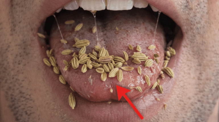 Ballonnements Digestion Fenouillèdes Gaz intestinaux Remèdes naturels Santé digestive