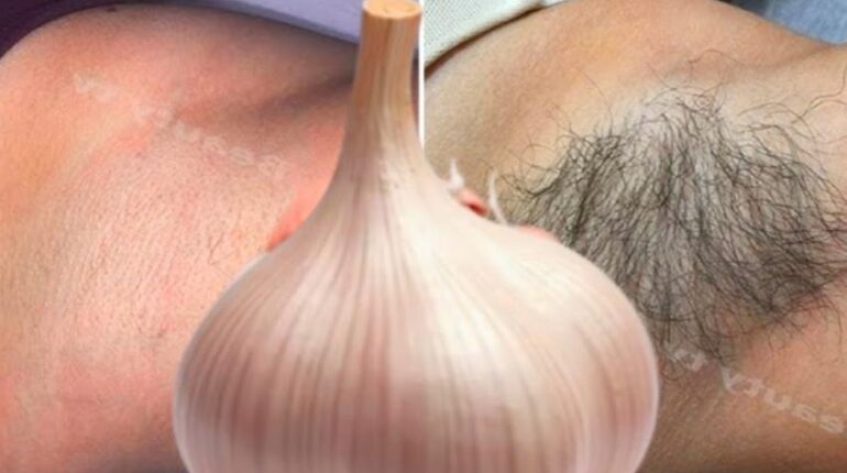 Beauté naturelle Blanc d'œuf citron Curcuma Épilation naturelle Remèdes maison Soin de la peau