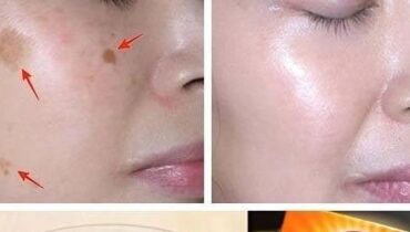 Beauté naturelle bicarbonate de soude Recettes maison Soins de la peau Taches brunes Teint unifié