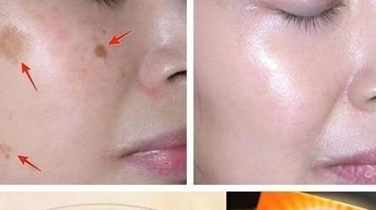 Beauté naturelle bicarbonate de soude Recettes maison Soins de la peau Taches brunes Teint unifié