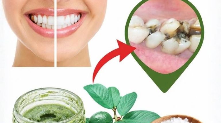 Feuilles de goyave Hygiène bucco-dentaire Remèdes maison Santé dentaire Soins naturels 