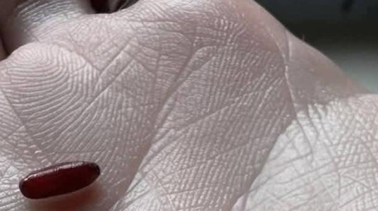 Alimentation Santé Anti-insectes Astuce de maison Compléments alimentaires Gélules medicaments 