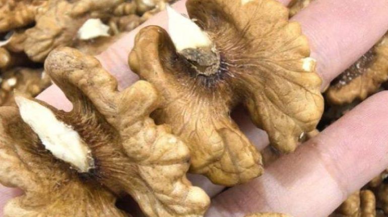 Alzheimer bien être Bienfaits des noix Carences Nutritionnelles mémoire Santé Cérébrale 