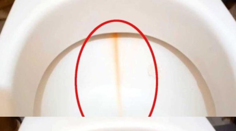 calcaire Entretien maison Mousse à raser Nettoyage bois tartre toilettes 