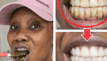 Blanchiment des dents Dents blanches Hygiène bucco-dentaire Remèdes maison Santé orale Soins dentaires 