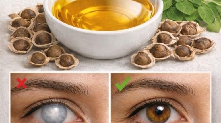 Antioxydants Bienfaits nutritionnels Graines de Moringa Moringa Phytothérapie Santé naturelle Superaliment 