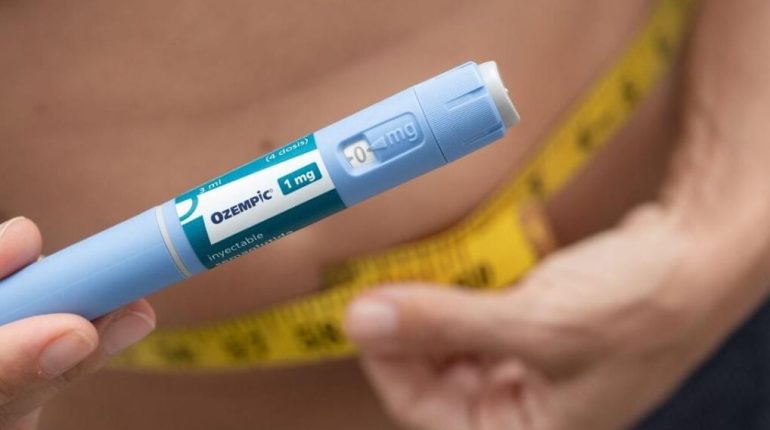 chirurgie esthétique effets secondaires Oreilles Ozempic perte de poids Sémaglutide 