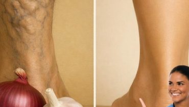 Absence au travail Ail et oignon Bien-être jambes Circulation sanguine Remèdes naturels Santé vasculaire 