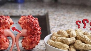 alimentation bien être Bienfaits nutritionnels Créatinine Graisses saines Santé Rénale 