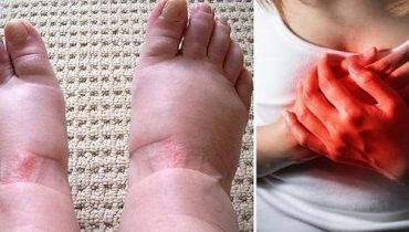 Alimentation Santé Alternatives foie gras maladies cardiaques Pieds gonflés Problèmes rénaux rétention d'eau symptômes 