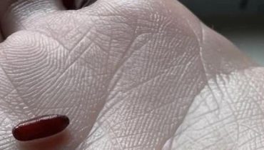 Alimentation Santé Infestation Literie Lutte antiparasitaire Nettoyage bois Punaises de lit 