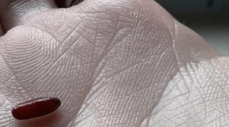 Alimentation Santé Infestation Literie Lutte antiparasitaire Nettoyage bois Punaises de lit 