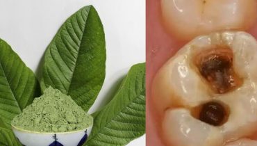 Feuilles de goyave gencives Hygiène alimentaire Remèdes naturels santé bucco-dentaire Soins naturels 