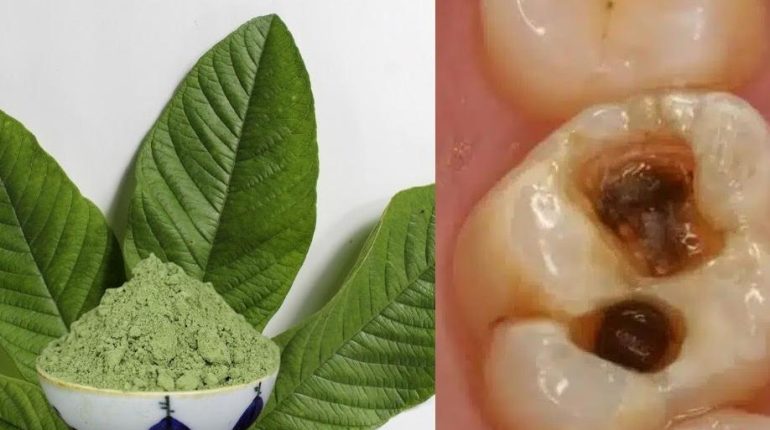 Feuilles de goyave gencives Hygiène alimentaire Remèdes naturels santé bucco-dentaire Soins naturels 