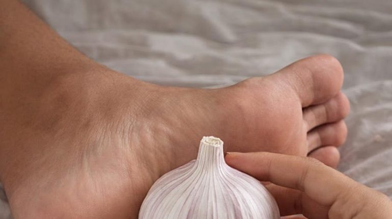 Absence au travail Alimentation Santé bien être Cancer de la peau Conscience corporelle Remèdes naturels 