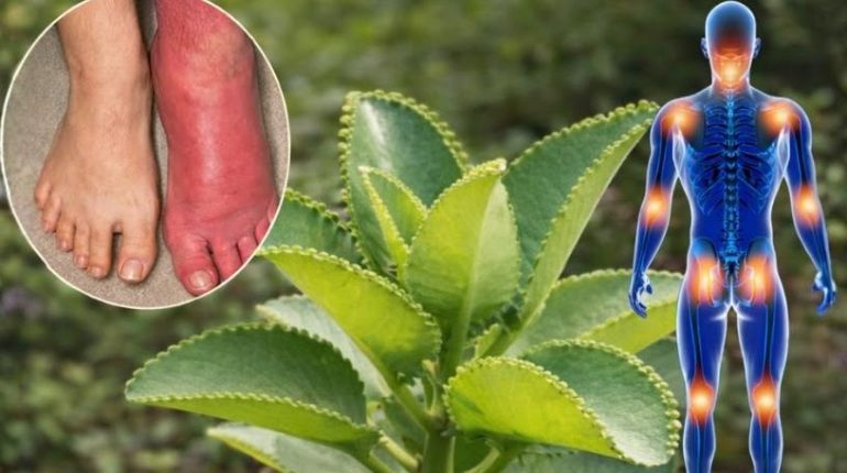 bien être confort respiratoire Douleurs articulaires Kalanchoe Plantes d'intérieur Remèdes naturels Santé naturelle 