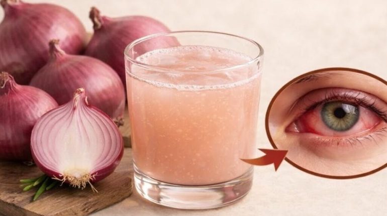 Actualités télévision Aliments santé Conduite dangereuse Oignons au four Remèdes maison Santé oculaire 