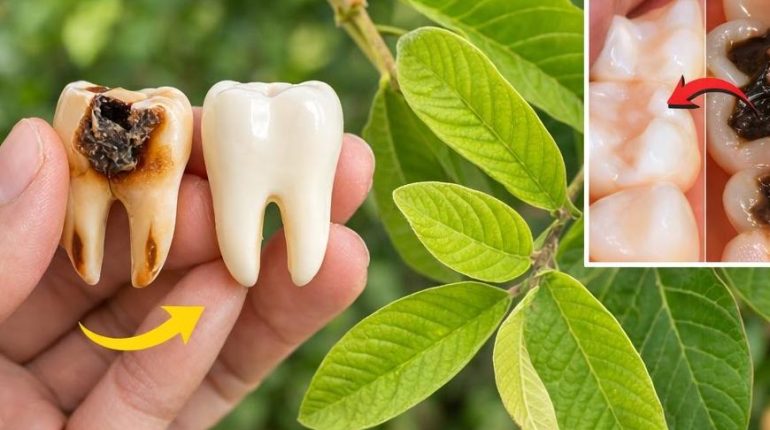 Goyavier Hygiène dentaire Plantes médicinales Remèdes naturels santé bucco-dentaire Soins dentaires 