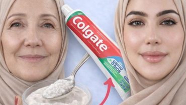 Anti-rides bicarbonate de soude Composition dentifrice Dermatologie Remèdes maison Soins de la peau Taches brunes 