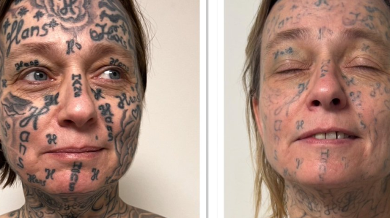 Aide aux victimes Détatouage Emprise psychologique Femmes victimes Tatouages forcés Violences conjugales 