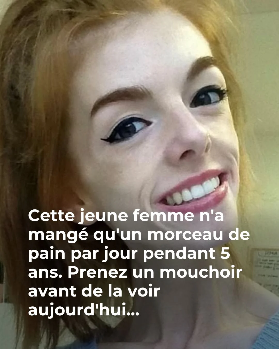 Anorexie : Annie Windley, de 29 kg à la ligne d&rsquo;arrivée d&rsquo;un semi-marathon