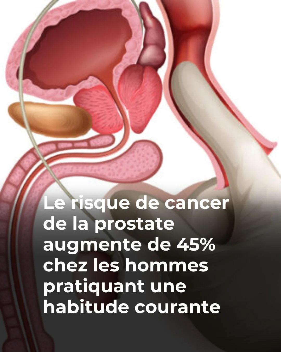 🚨 Cette habitude que des millions d’hommes font augmente le risque 😱 😳👇Voir plus
