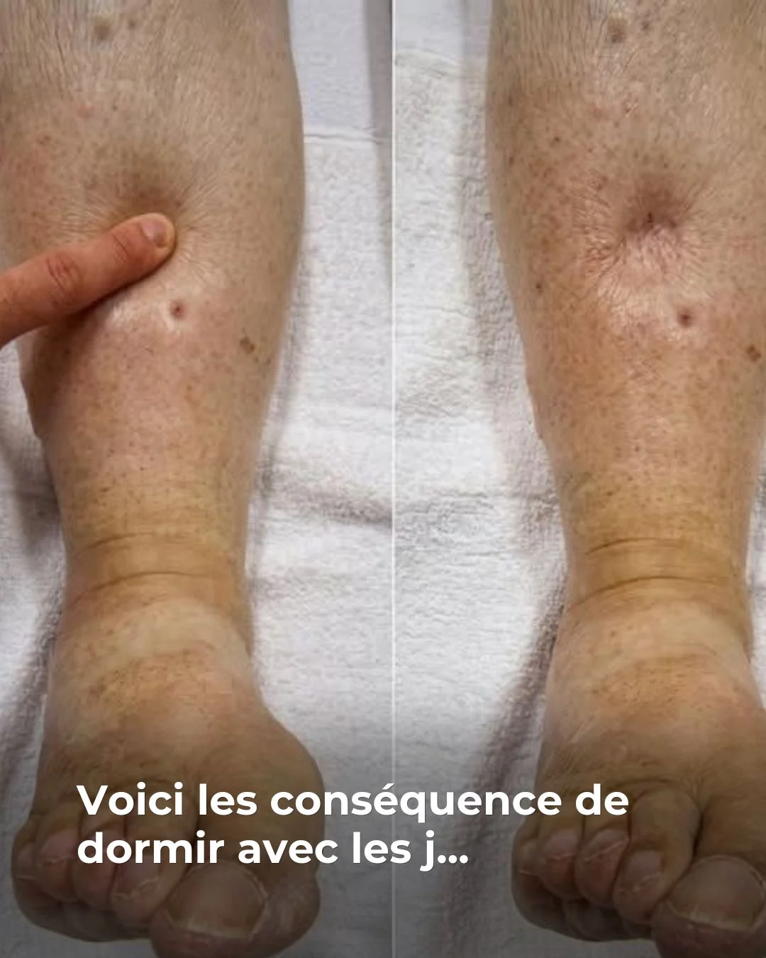 Voici les conséquence de dormir avec les j...Voir plus