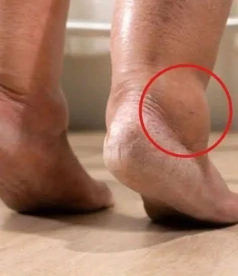 Pieds gonflés : 10 remèdes naturels pour les soulager rapidement