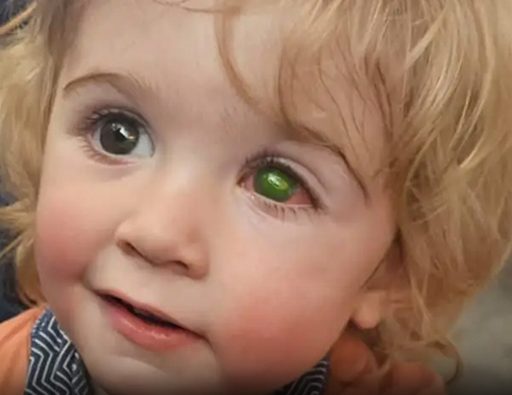 un-herpes-transmis-par-un-baiser-rend-un-enfant-av cover