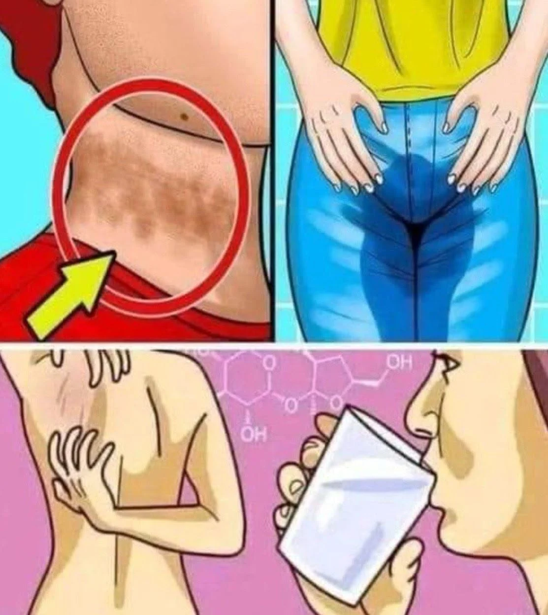 Carence en vitamine D : 10 symptômes qui doivent alerter