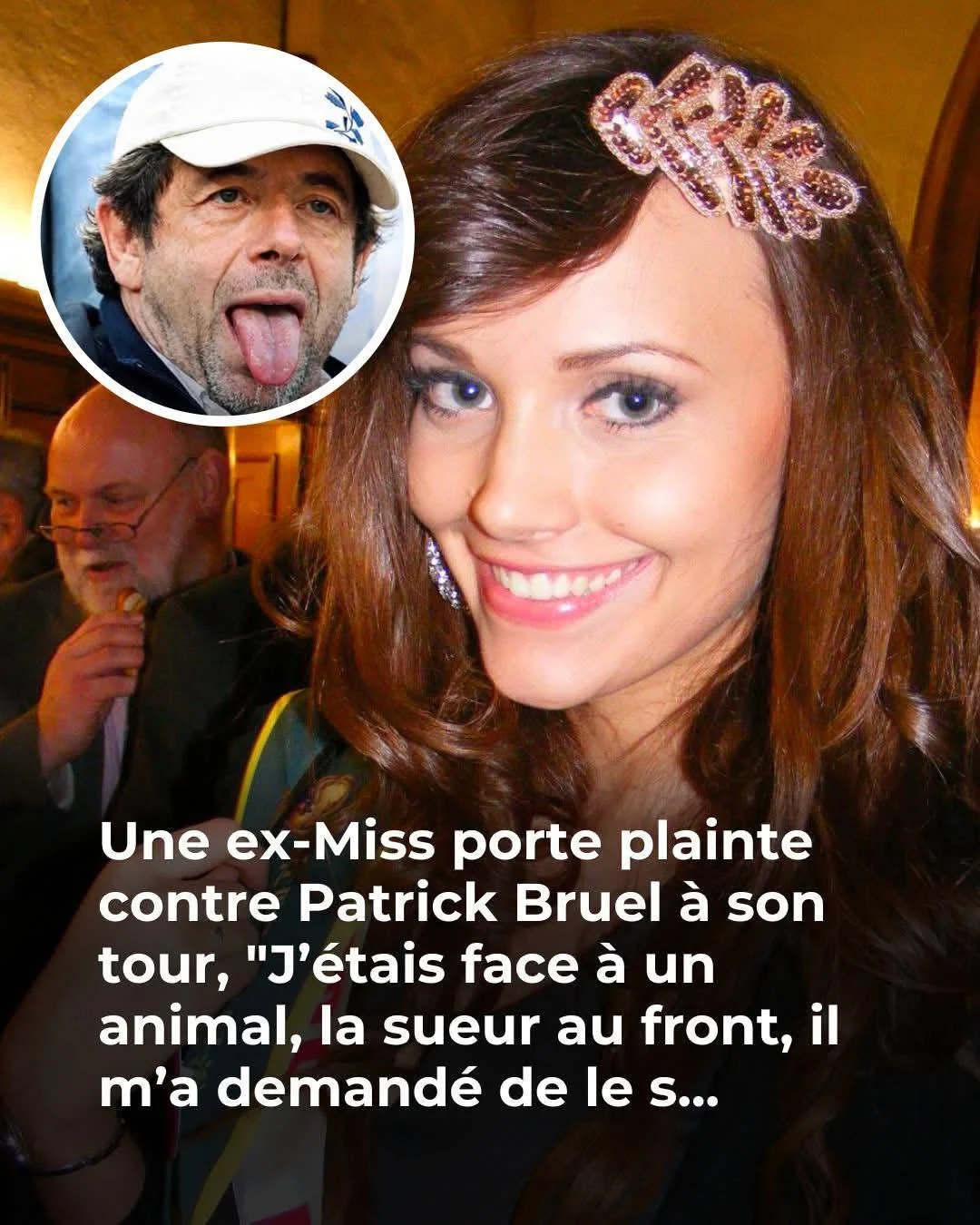 Patrick Bruel en garde à vue : une ex-Miss témoigne de viol