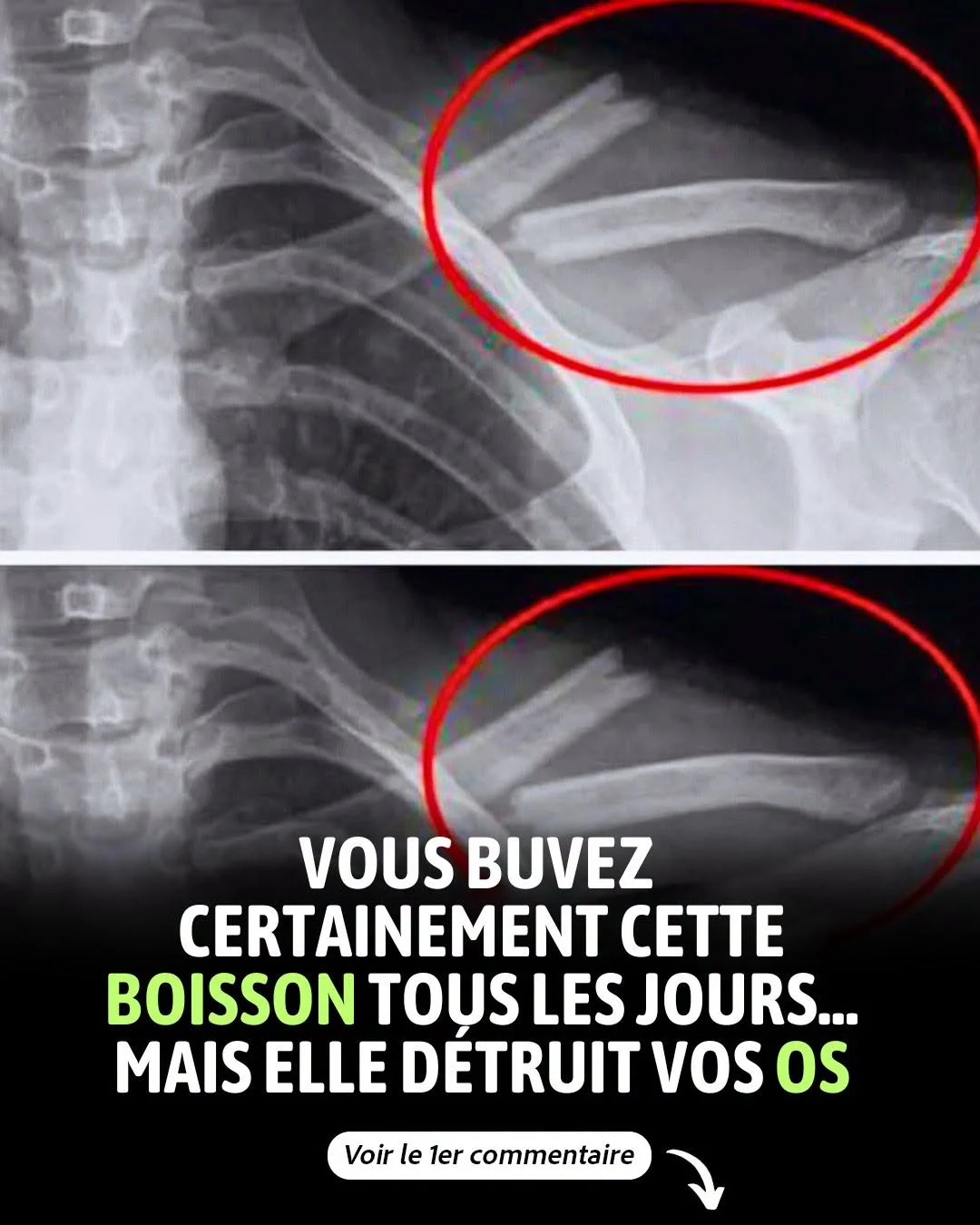 Sodas, bière, énergie : ces boissons qui déshydratent par temps chaud