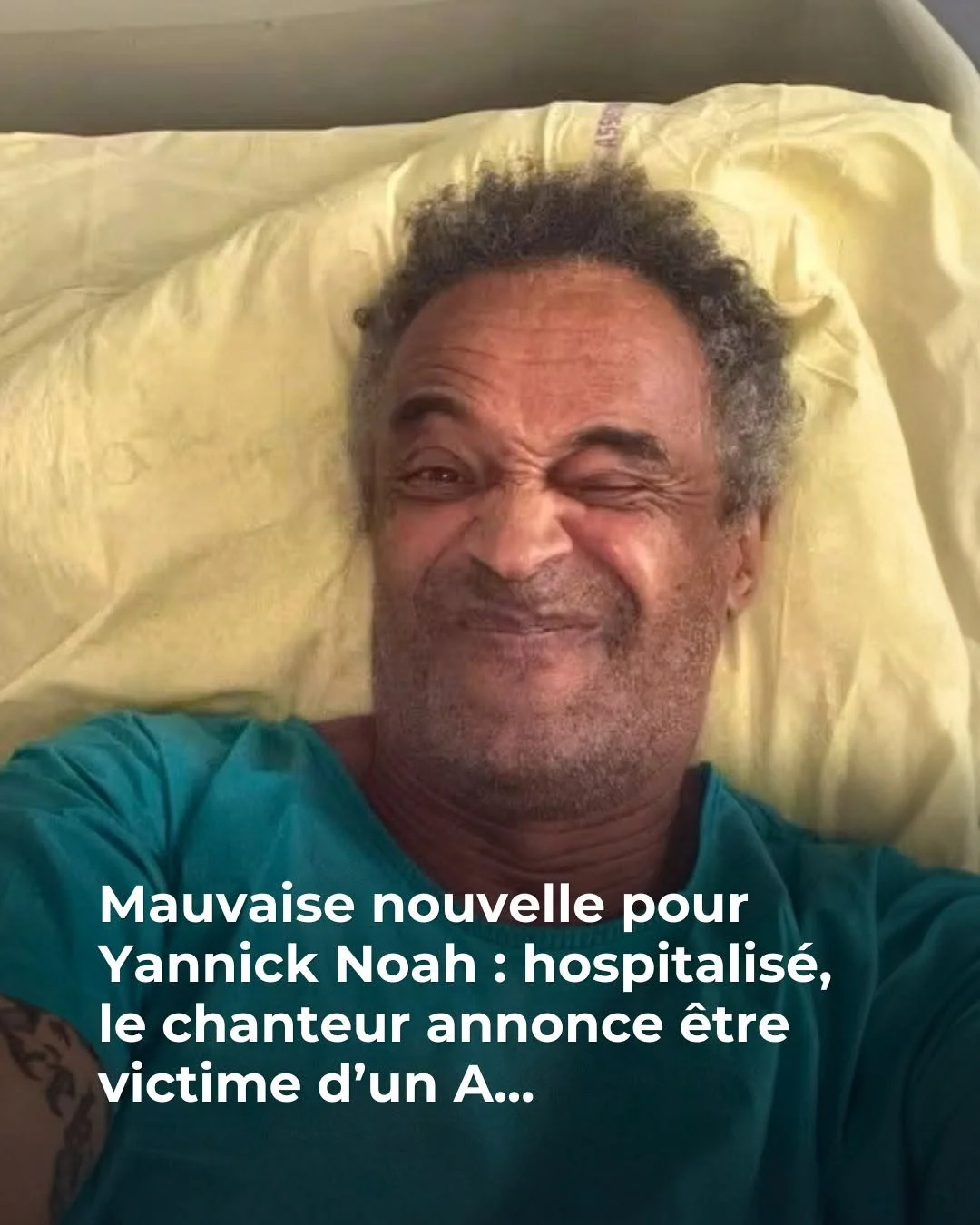 Yannick Noah hospitalisé pour une appendicite à 66 ans