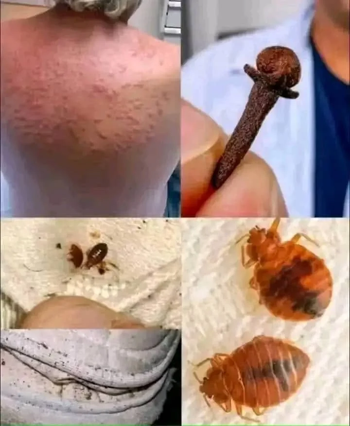 Le Kissing Bug transmet une maladie mortelle : ce qu&rsquo;il faut savoir