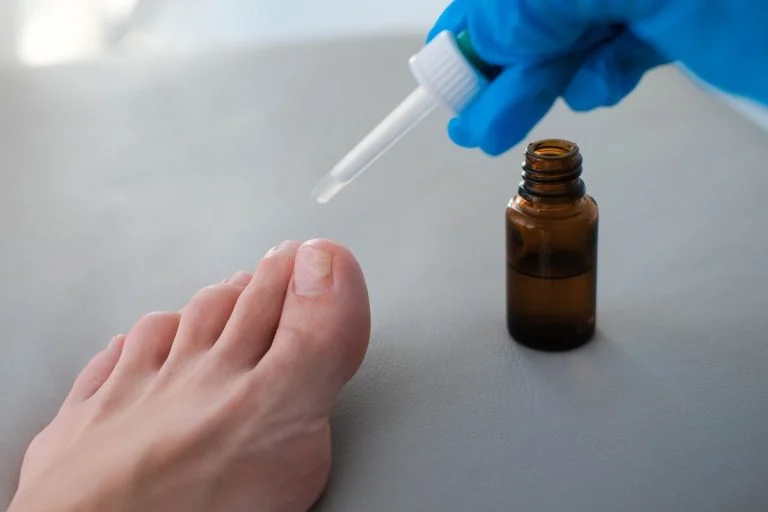 mycose-des-ongles-le-vinaigre-blanc-comme-remede-n cover
