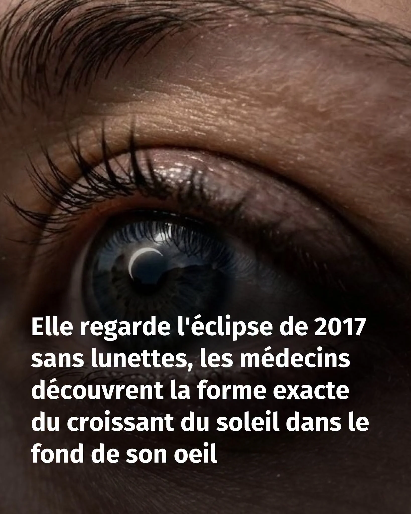 Éclipse 2017: 6 secondes sans lunettes, un croissant gravé dans sa rétine