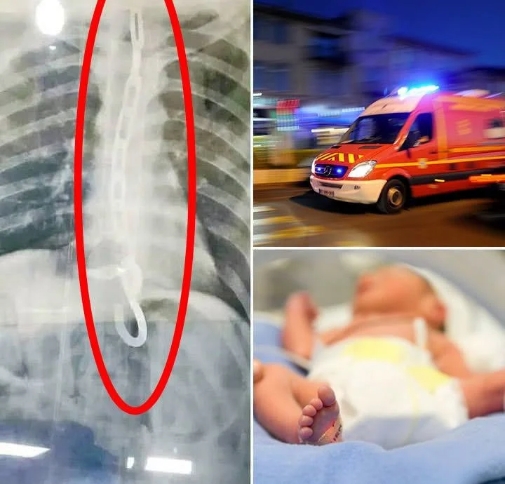 Paille en verre cassée: un jeune de 23 ans perd 4 litres de sang