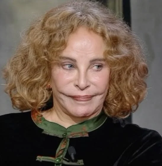 Sydne Rome: le retour de l'actrice après son accident de 2009 cover